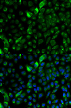 Immunofluorescence analysis of A-549 cells using KRT17 Polyclonal Antibody