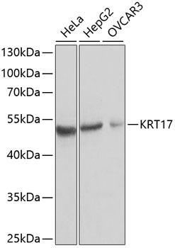 Western blot analysis of extracts of various cell lines using KRT17 Polyclonal Antibody at dilution of 1:1000.