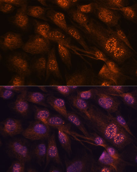Immunofluorescence analysis of C6 cells using MAP2K7 Polyclonal Antibody at dilution of  1:100. Blue: DAPI for nuclear staining.