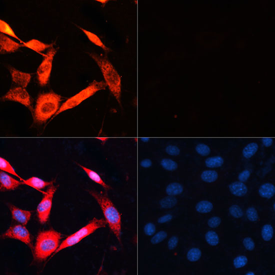 Immunofluorescence analysis of NIH/3T3 cells using P70 S6K Polyclonal Antibody at dilution of  1:100.NIH/3T3 cells were treated by Serum-starvation overnight at 37℃. Blue: DAPI for nuclear staining.