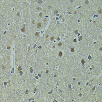 Immunohistochemistry of paraffin-embedded Rat brain using UBE2I Polyclonal Antibody at dilution of  1:100 (40x lens).