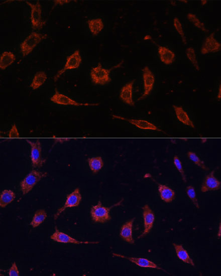 Immunofluorescence analysis of L929 cells using TOLLIP Polyclonal Antibody at dilution of  1:100. Blue: DAPI for nuclear staining.