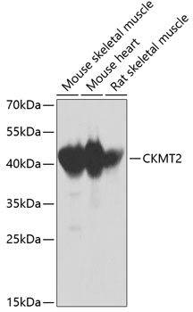 Western blot analysis of extracts of various cell lines using CKMT2 Polyclonal Antibody at dilution of 1:1000.