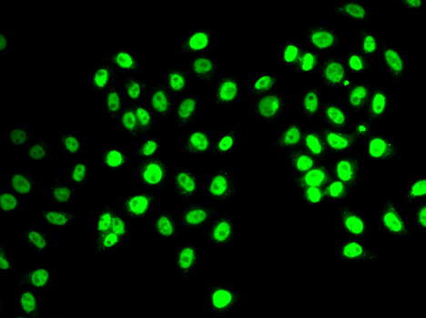 Immunofluorescence analysis of MCF-7 cells using REST Polyclonal Antibody