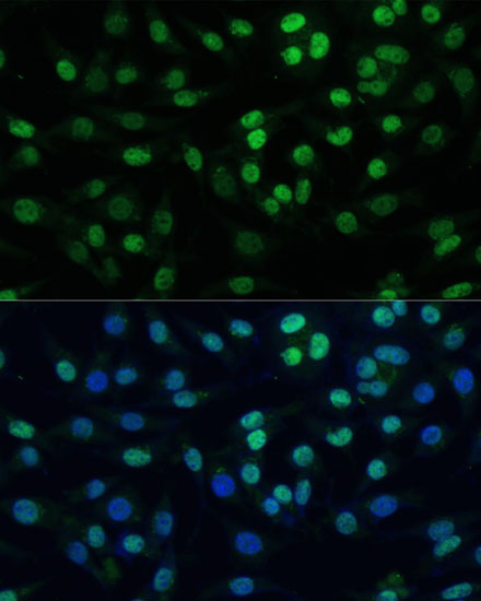 Immunofluorescence analysis of L929 cells using TRIM28 Polyclonal Antibody at dilution of  1:100 (40x lens). Blue: DAPI for nuclear staining.