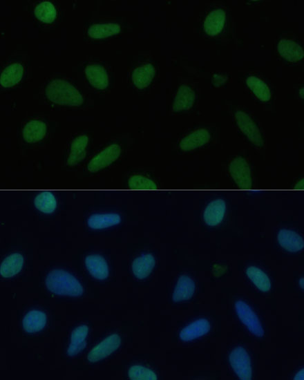 Immunofluorescence analysis of U-2 OS cells using TRIM28 Polyclonal Antibody at dilution of  1:100 (40x lens). Blue: DAPI for nuclear staining.