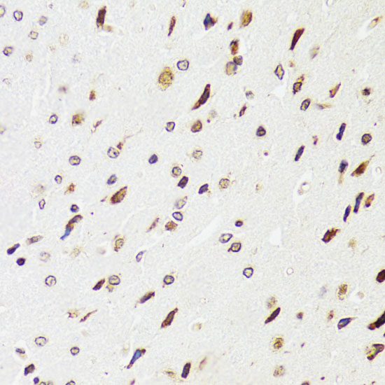 Immunohistochemistry of paraffin-embedded Rat brain using EDF1 Polyclonal Antibody at dilution of  1:100 (40x lens).