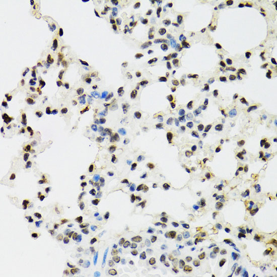 Immunohistochemistry of paraffin-embedded Mouse lung using EDF1 Polyclonal Antibody at dilution of  1:100 (40x lens).