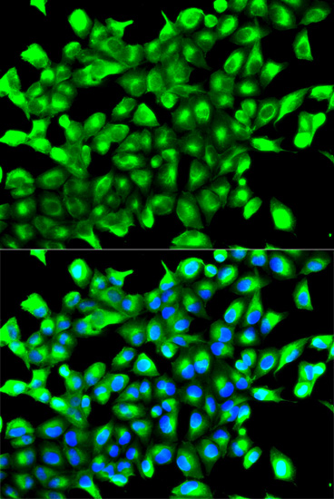 Immunofluorescence analysis of MCF-7 cells using EGLN1 Polyclonal Antibody