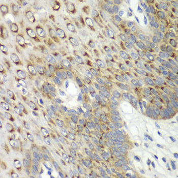 Immunohistochemistry of paraffin-embedded Human esophagus using CDK1 Polyclonal Antibody at dilution of  1:100 (40x lens).