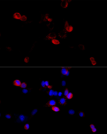 Immunofluorescence analysis of HeLa cells using FLNB Polyclonal Antibody at dilution of  1:100 (40x lens). Blue: DAPI for nuclear staining.