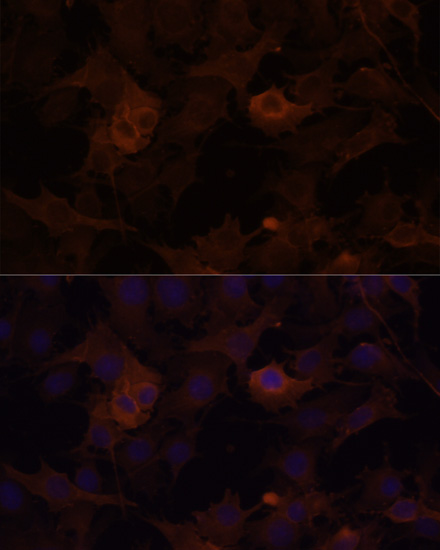 Immunofluorescence analysis of HUVEC cells using FLNB Polyclonal Antibody at dilution of  1:100 (40x lens). Blue: DAPI for nuclear staining.