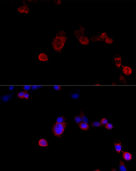 Immunofluorescence analysis of NIH/3T3 cells using FLNB Polyclonal Antibody at dilution of  1:100 (40x lens). Blue: DAPI for nuclear staining.