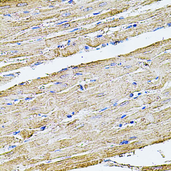 Immunohistochemistry of paraffin-embedded Rat heart using FLNB Polyclonal Antibody at dilution of  1:100 (40x lens).