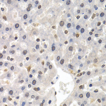 Immunohistochemistry of paraffin-embedded Rat liver using GTF2F1 Polyclonal Antibody at dilution of  1:200 (40x lens).