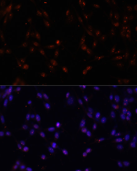 Immunofluorescence analysis of NIH-3T3 cells using ILF3 Polyclonal Antibody at dilution of  1:100. Blue: DAPI for nuclear staining.