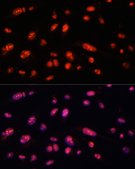 Immunofluorescence analysis of U-2 OS cells using ILF3 Polyclonal Antibody at dilution of  1:100. Blue: DAPI for nuclear staining.