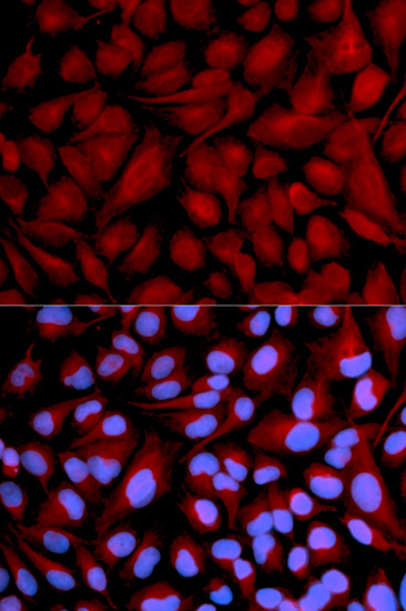 Immunofluorescence analysis of U2OS cells using CASK Polyclonal Antibody