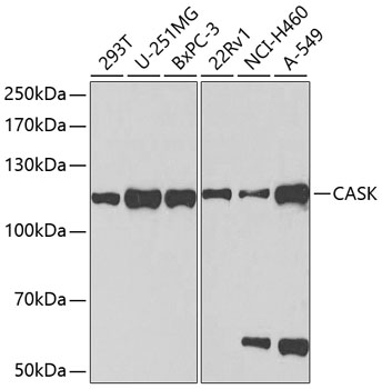 Western blot analysis of extracts of various cell lines using CASK Polyclonal Antibody at dilution of 1:1000.