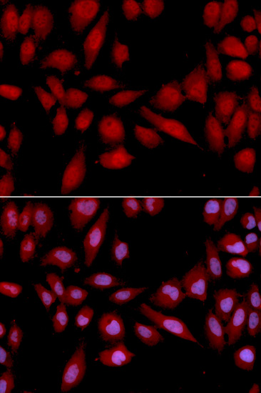 Immunofluorescence analysis of U2OS cells using PSMA2 Polyclonal Antibody