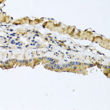 Immunohistochemistry of paraffin-embedded Mouse lung using ATP2C1 Polyclonal Antibody at dilution of  1:100 (40x lens).