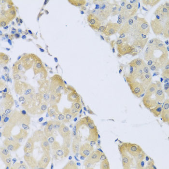 Immunohistochemistry of paraffin-embedded Human stomach using ATP2C1 Polyclonal Antibody at dilution of  1:100 (40x lens).