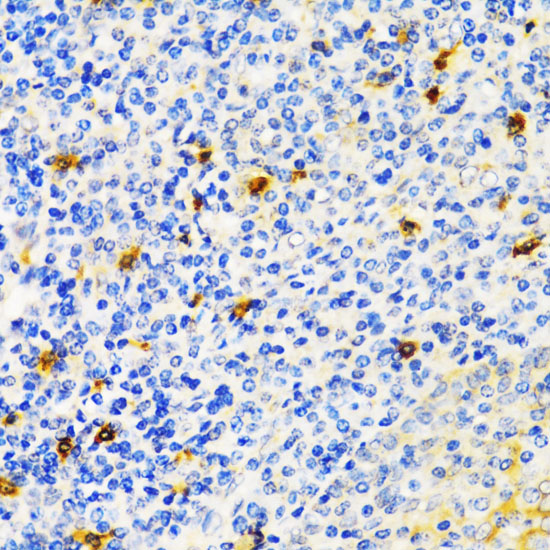 Immunohistochemistry of paraffin-embedded Human tonsil using TIM-3/HAVCR2 Polyclonal Antibody at dilution of  1:200 (40x lens).
