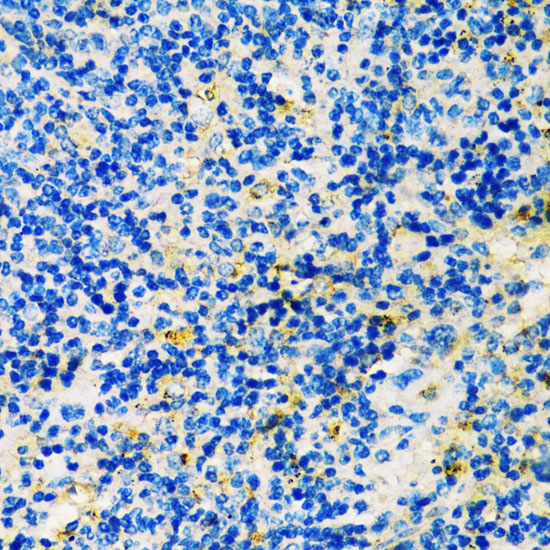 Immunohistochemistry of paraffin-embedded Mouse spleen using TIM-3/HAVCR2 Polyclonal Antibody at dilution of  1:200 (40x lens).