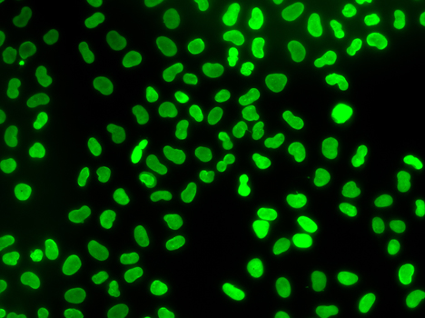 Immunofluorescence analysis of U2OS cells using TMPO Polyclonal Antibody