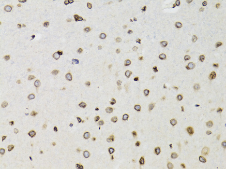 Immunohistochemistry of paraffin-embedded Rat brain using TMPO Polyclonal Antibody at dilution of  1:100 (40x lens).