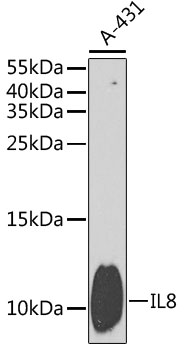 Western blot analysis of extracts of A-431 cells using IL8 Polyclonal Antibody at dilution of 1:1000.