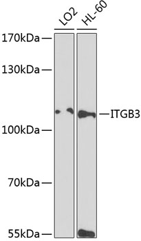 Western blot analysis of extracts of various cell lines using ITGB3 Polyclonal Antibody at dilution of 1:1000.