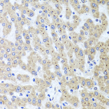 Immunohistochemistry of paraffin-embedded Human liver damage using ADIPOQ Polyclonal Antibody at dilution of  1:100 (40x lens).