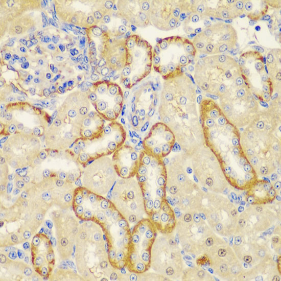 Immunohistochemistry of paraffin-embedded Rat kidney using MT1-MMP Polyclonal Antibody at dilution of  1:100 (40x lens).