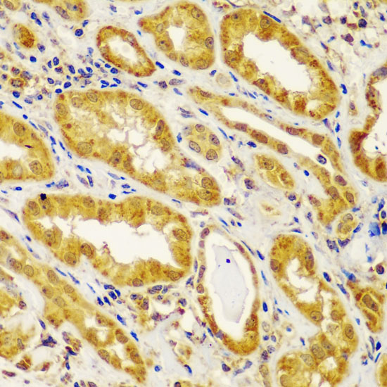 Immunohistochemistry of paraffin-embedded Human kidney using MT1-MMP Polyclonal Antibody at dilution of  1:100 (40x lens).