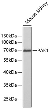 Western blot analysis of extracts of Mouse kidney using PAK1 Polyclonal Antibody at dilution of 1:1000.