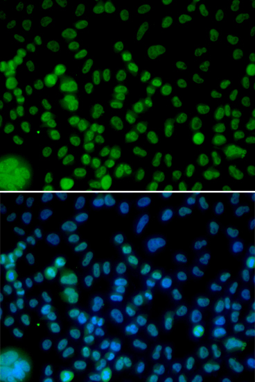 Immunofluorescence analysis of HeLa cells using IRF2 Polyclonal Antibody