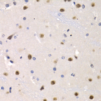 Immunohistochemistry of paraffin-embedded Rat brain using IRF2 Polyclonal Antibody at dilution of  1:200 (40x lens).