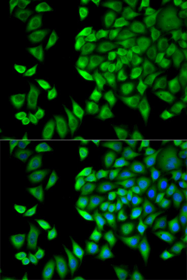 Immunofluorescence analysis of HeLa cells using WNK1 Polyclonal Antibody