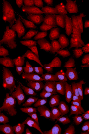 Immunofluorescence analysis of U2OS cells using MAP2K6 Polyclonal Antibody