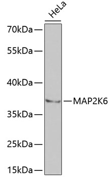 Western blot analysis of extracts of HeLa cells using MAP2K6 Polyclonal Antibody at dilution of 1:1000.