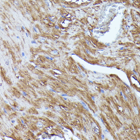 Immunohistochemistry of paraffin-embedded Mouse heart using N-WASP Polyclonal Antibody at dilution of  1:100 (40x lens).