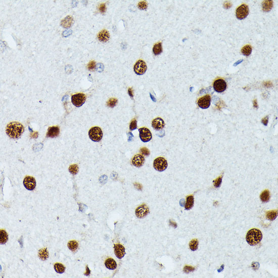 Immunohistochemistry of paraffin-embedded Rat brain using MEF2C Polyclonal Antibody at dilution of  1:100 (40x lens).