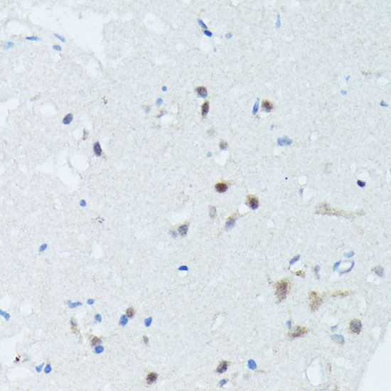 Immunohistochemistry of paraffin-embedded Human brain using MEF2C Polyclonal Antibody at dilution of  1:100 (40x lens).