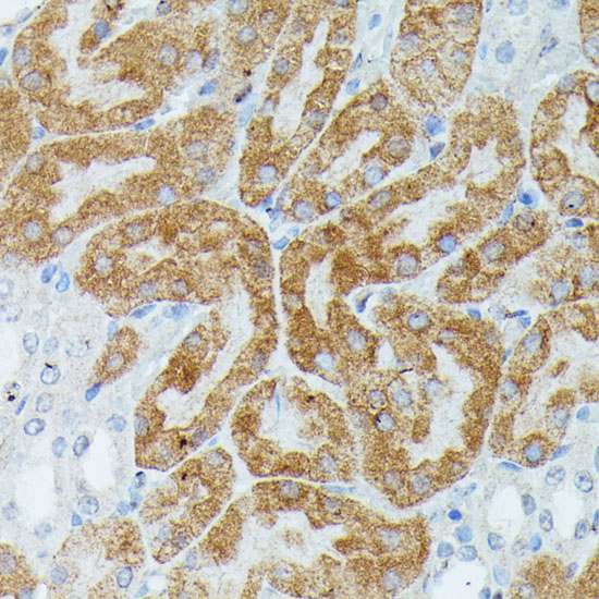 Immunohistochemistry of paraffin-embedded Mouse kidney using MEF2C Polyclonal Antibody at dilution of  1:100 (40x lens).