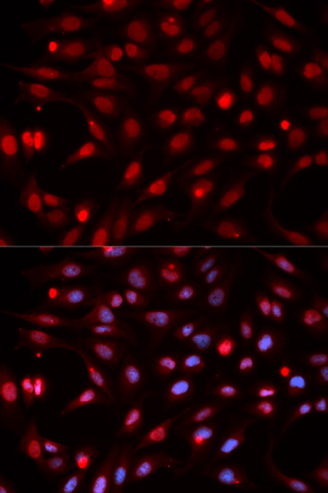 Immunofluorescence analysis of HeLa cells using APEX1 Polyclonal Antibody