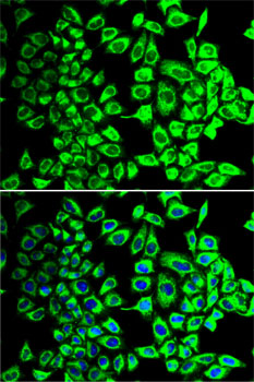 Immunofluorescence analysis of HeLa cells using SDHA Polyclonal Antibody