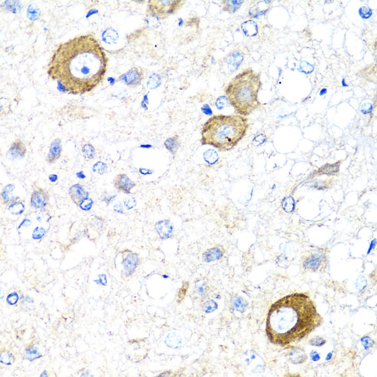 Immunohistochemistry of paraffin-embedded Rat brain using NRG4 Polyclonal Antibody at dilution of  1:100 (40x lens).