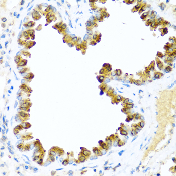 Immunohistochemistry of paraffin-embedded Mouse lung using NRG4 Polyclonal Antibody at dilution of  1:100 (40x lens).