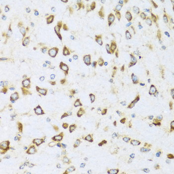 Immunohistochemistry of paraffin-embedded Mouse brain using NRG4 Polyclonal Antibody at dilution of  1:100 (40x lens).